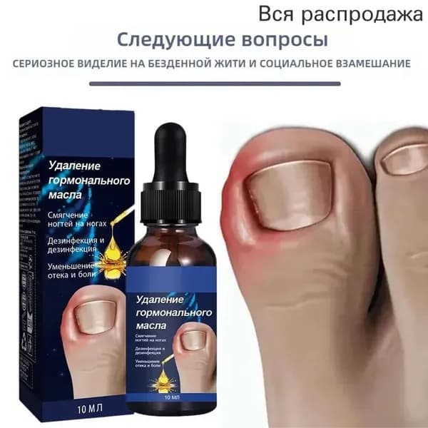 20г Вросшие ногти на ногах, для ухода за ногтями на ногах,удаляется масло паронихии