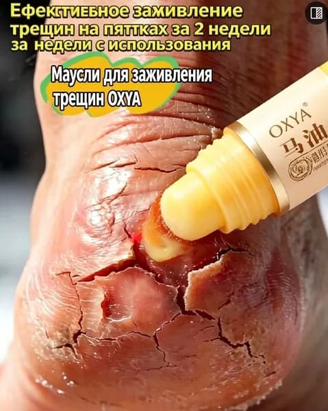 крем от трещин на пятках, стик для ног, конское масло для увлажнения кожи, уход за пятками, средство от сухости ног, мозоли и натоптыши, зимний уход за кожей, компактный крем для рук и ног