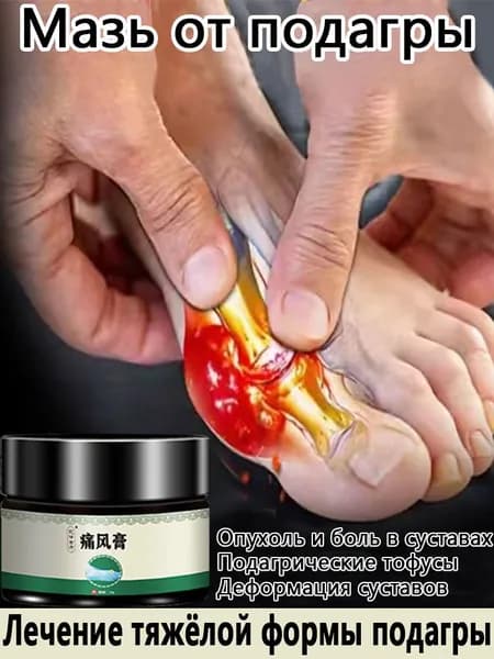 Мазь для суставов обезболивающая 35мл отеков суставов рук и ног,для лечения
