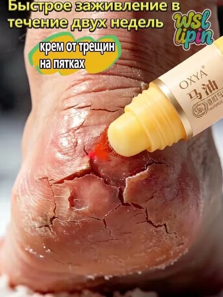 Крем воск от трещин для очень сухой кожи, крем для ног с мочевиной 5%, от трещин на пятках, воск для пяток