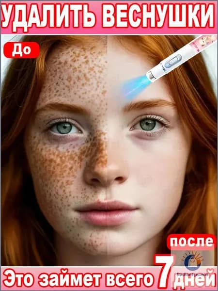 Лазерное удаление веснушек быстро и эффективно удаляет веснушки, пигментные пятна, мелазму и другие виды пигментации; осветляет и выравнивает тон кожи. 1 шт.