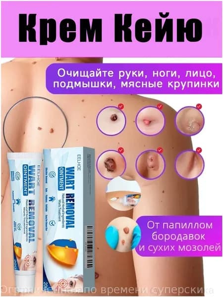Качественный крем для ликвидации папиллом, родинок и бородавок, изготовленный на базе природных фитокомпонентов, в фасовке 20 граммов, применяемый для дерматологического ухода.