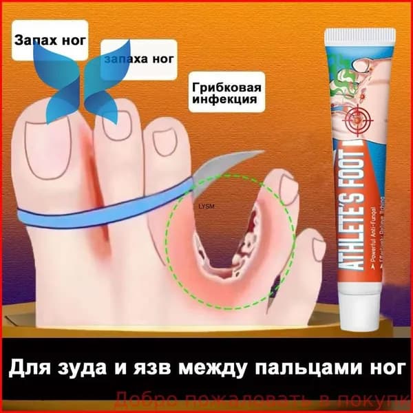 Средство от запаха ног для зуда и язв между пальцами, против грибка, дезодорант эффективное 20г