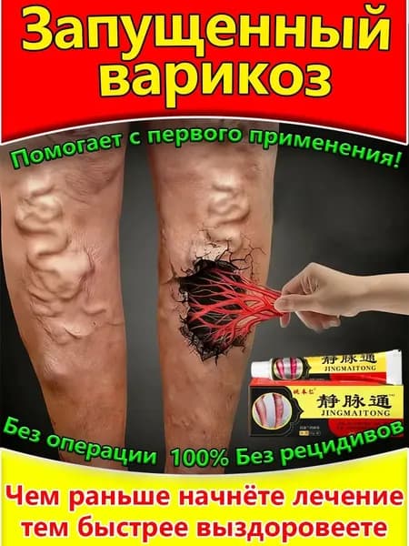 Китайская мазь от варикоза вен на ногах Джинг Май Тонг 2 шт.