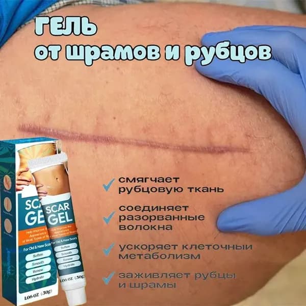Гель для лечения различных рубцов, ожогов, растяжек и пигментных пятен, для борьбы с угревой сыпью на лице и теле, 30 грамм
