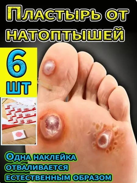 Пластырь от мозолей, бородавок и натоптышей лечебный, 6 штук