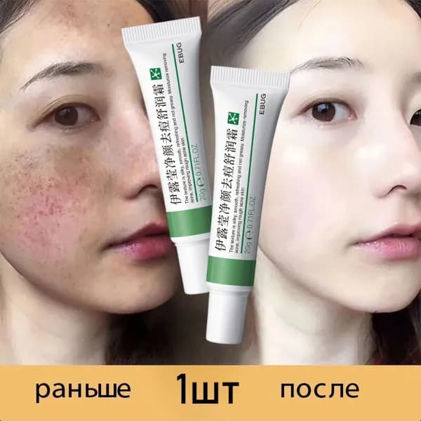 Крем Против Веснушек, Отбеливающий, Укрепляющий, Омолаживающий, Удаляющий Морщины, Увлажняющий