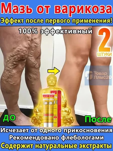 2 шт.мазь от варикоза вен на ногах