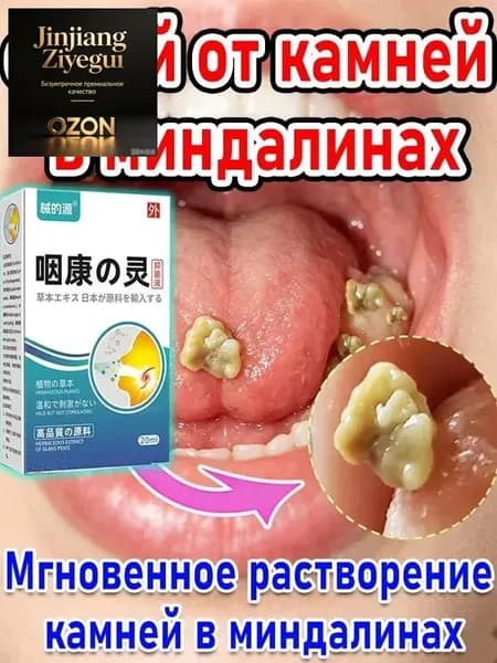 Новинка!Набор для удаления миндалинов камней + спрей
