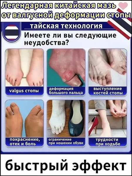 Премиумсредство из Тайланда от вальгуса