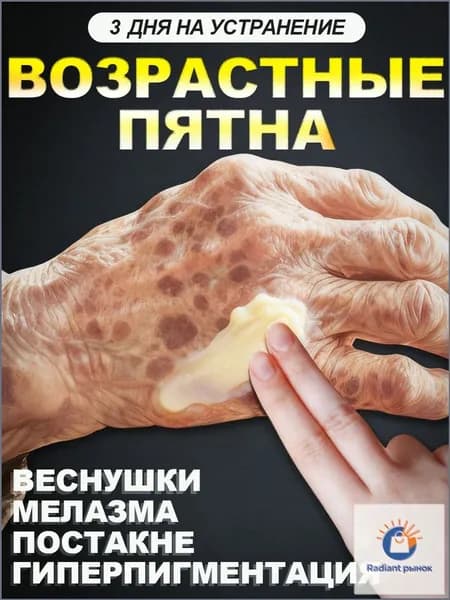 ретидерм крем для лица антивозрастной,Крем для удаления веснушек и отбеливания способен удалить веснушки,хлоазму,солнечные пятна,пигментные пятна, Содержит гиалуроновую кислоту и 377.