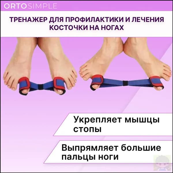 Тренажер для профилактики и лечения косточки на ногах, Выпрямитель больших пальцев при косточках