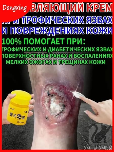 Качественный крем создан для сухих трещин и трофических язв