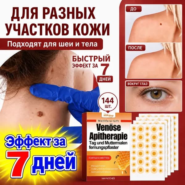 Пластырь от папиллом, бородавок, родинок,угревой сыпи 144шт(10)
