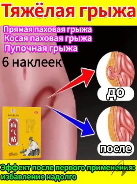 Пластырь от симптомов паховой грыжи: боль и тяжесть внизу живота