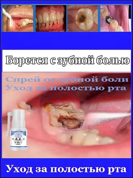 Спрей от зубной боли, лечит зубную боль, быстро снимает боль