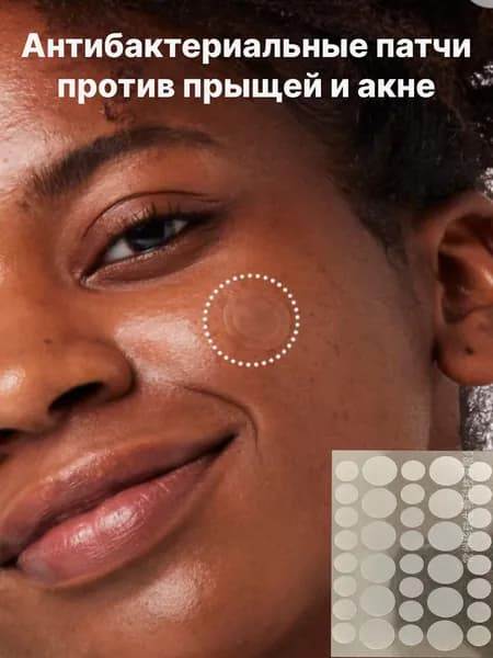 Патчи от прыщей гидроколлоидные