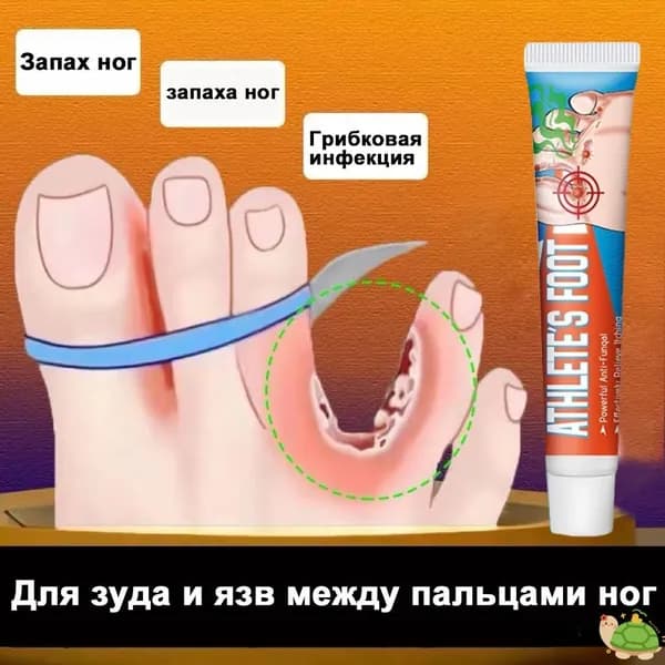 Средство от запаха ног для зуда и язв между пальцами, против грибка, дезодорант эффективное 20г