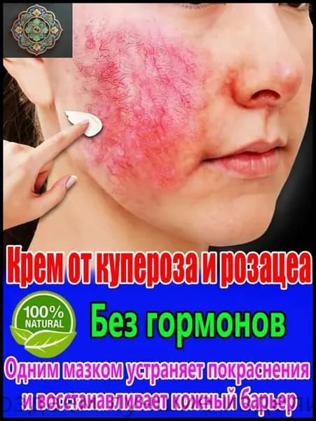 Крем от купероза и покраснений "Тонус-Капилляр Лица", 20 мл