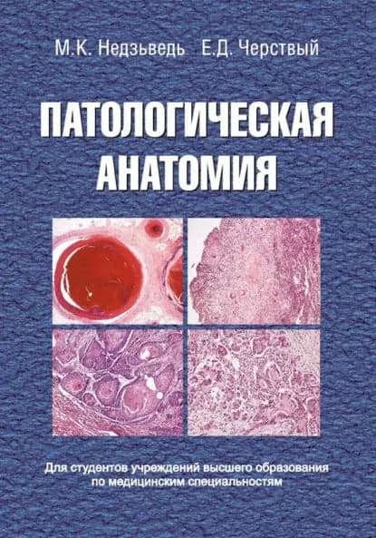 Патологическая анатомия | Недзьведь Михаил Константинович, Черствой Евгений Давыдович | Электронная книга