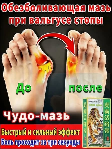 Эксклюзивная мазь для лечения косточек и шишек на больших пальцах ног