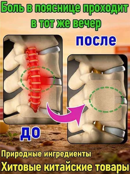 Пластырь при грыже поясничного диска и болях в спине,8 шт