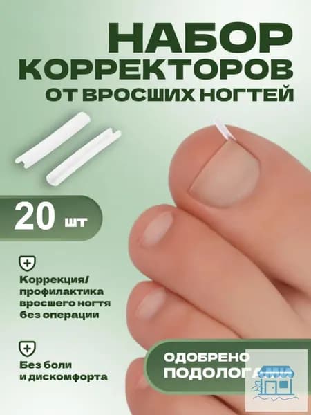 Корректор От Вросших Ногтей На Ногах