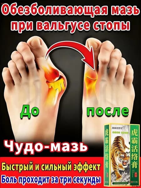 мазь от косточки на большом пальце, от шишек на больших пальцах ног