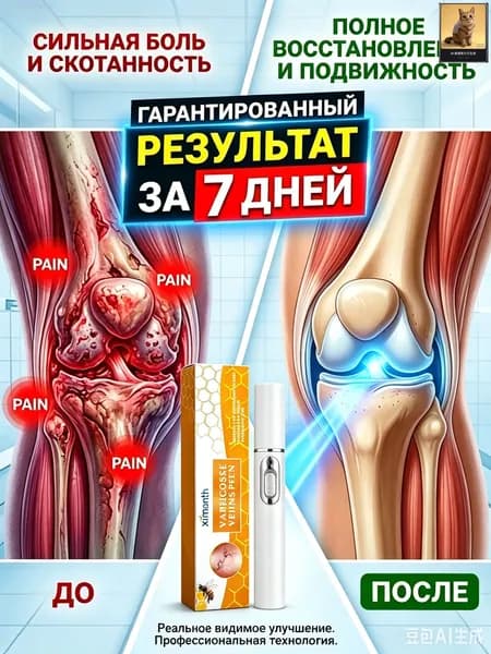 Обезболивающий лазерная указка при артрите,для снятия боли при подагре, артрите, опухших суставах, болях в спине, уменьшает отек и снимает боль,1 ШТ