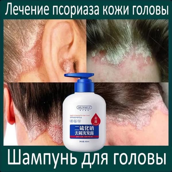 Шампунь для волос, 300 мл