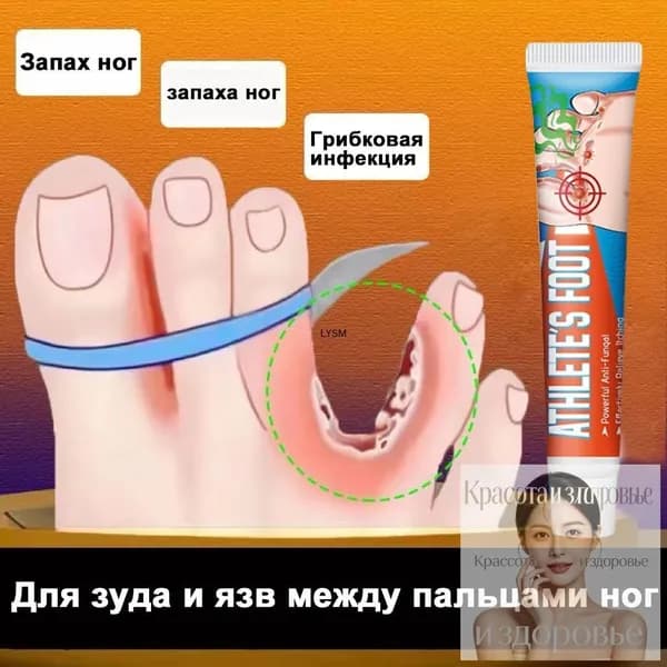 Средство от запаха ног для зуда и язв между пальцами, против грибка, дезодорант эффективное 20г