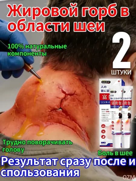 мазь для устранения жирового образования на шее,2 штуки