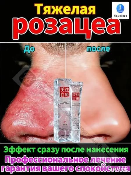 Крем от акне и розацеа ИВЕРЛАЙТ 1%Крем для лица от розацеа, купероза и эритемысыворотка для лица от прыщей,Эри
