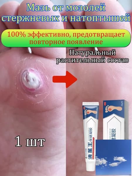 Mазь от мозолей стержневых и натоптышей ,Крем от сухих мозолей, шипицы, бородавок, натоптышей,20 г 1 шт.(1)