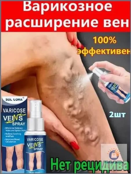 Спрей от варикоза, 60мл , эффективен при сосудистых звездочках, тромбозе, фитокрем для укрепления сосудов, вен, от тяжести ног, венозные воспаления и облегчает состояние при варикозе