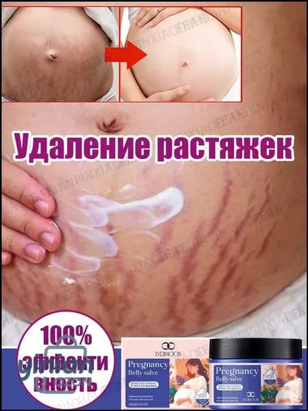 Крем от растяжек для беременных, Быстрое удаление растяжек, пигментации и шрамов,Послеродовые абдоминальные линии,восстанавливает эластичность кожи, подходит для ухода за кожей после родов 120 г.