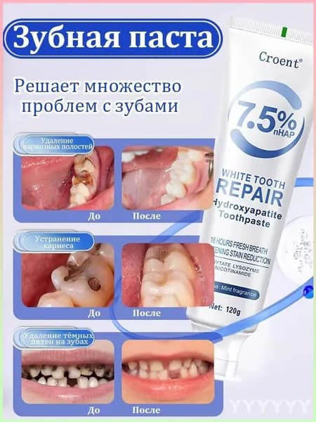 Зубная паста с 7,5% гидроксиапатита, лечит кариес и неприятный запах изо рта, восстанавливает зубы, способствует реминерализации эмали, снижает чувствительность, 120 г