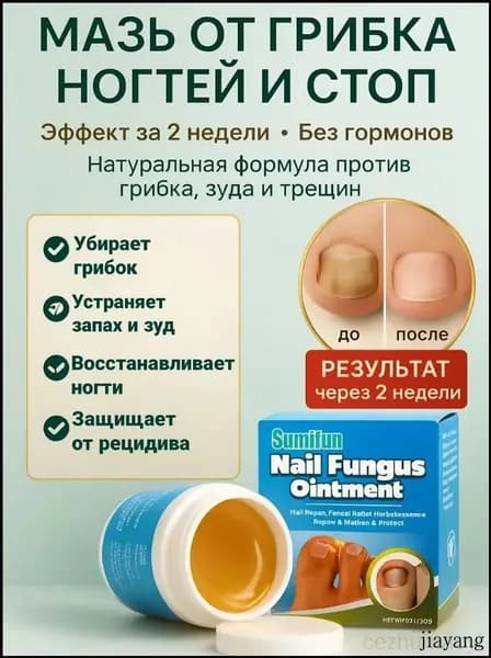 Мазь от грибка ногтей / Крем для эффективной борьбы с несовершенствами / Чудо средство для ухода за ногами против онихолизиса