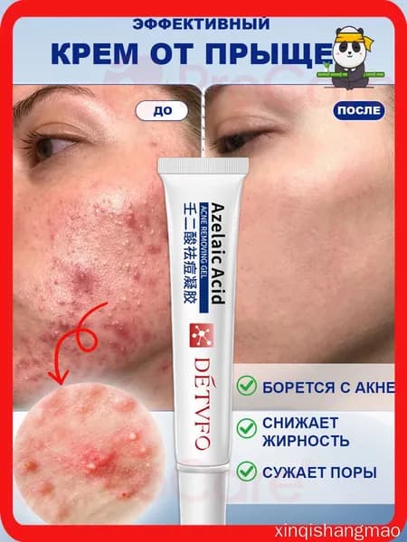 Крем от прыщей для лица DETVFO, для проблемной кожи, 20 мл