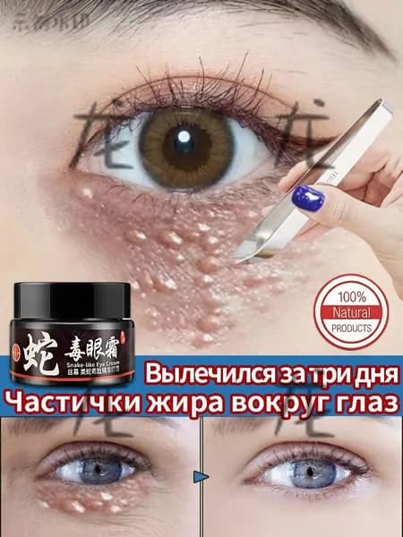 средство от милиумов на лице, Крем для век антивозрастной, для зоны вокруг глаз, от темных кругов и морщин, отё