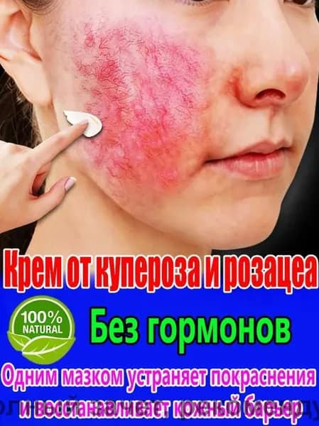 Крем от купероза и покраснений "Тонус-Капилляр Лица", 20 мл