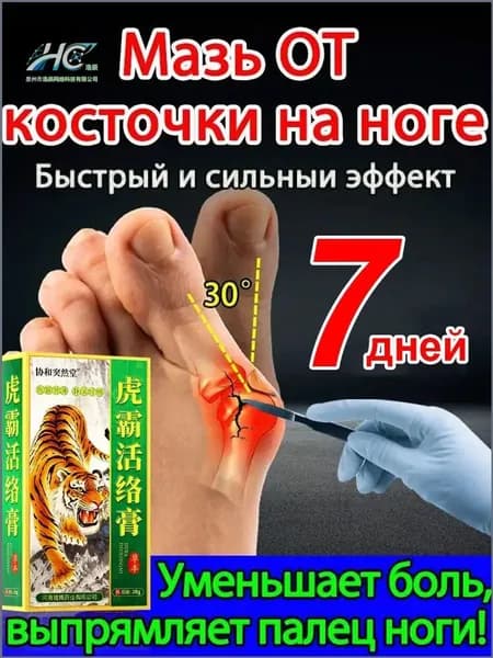 Мазь от вальгусной деформации стопы/20 мл, специальная для лечения воспаленных костей стопы