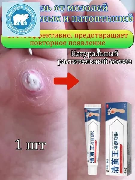 Mазь от мозолей стержневых и натоптышей ,Крем от сухих мозолей, шипицы, бородавок, натоптышей,20 г 1 шт.