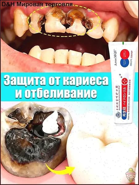 Зубная паста для дырки в зубе, глубокого кариеса и пульпита, Снимает боль, восстанавливает при поражении кариесом у взрослых, Свежее дыхание, 100 г, 1 шт.