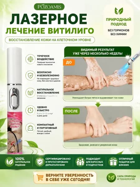 Лазерная ручка, разработанная специально для витилиго, точно осветляет белые пятна и выравнивает тон кожи. Без боли всего один стик поможет вернуть чистой, ровной и сияющей здоровой коже.