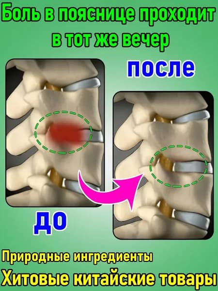 Пластырь при грыже поясничного диска и болях в спине, 8 шт