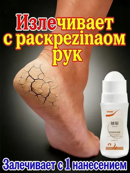Лечение сухих трещин на руках и ногах
