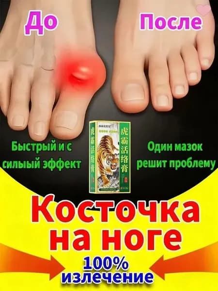 Крем от вальгусной деформации и шишек на ногах, 20 мл