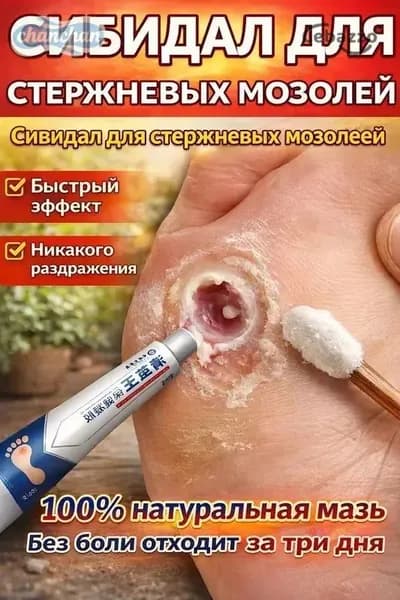 Средство от шипиц, натоптышей и сухих стержневых мозолей на ногах мазь и гель Корнекс,эффективное китайское средство