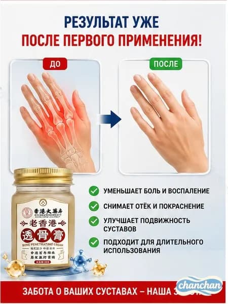 Мазь от артрита, Устранение боли при воспалении суставов, коленях, пальцах рук и т. д, на конечностях и для спины и артроза 50 г